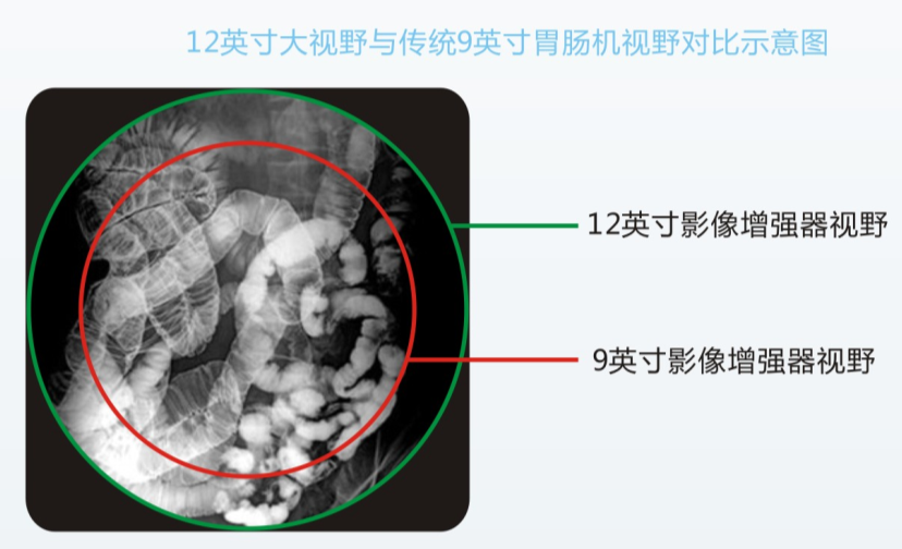 胃肠机检查