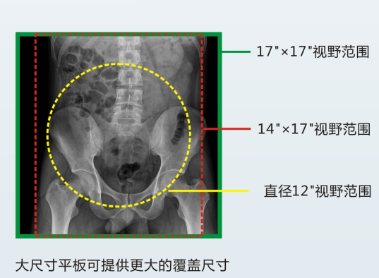 多功能DR成像视野